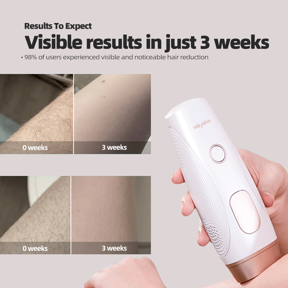 Hikyskin Clean-1 Disinfection IPL Hair Removal Device